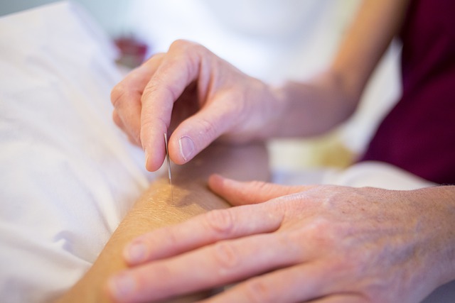 man performs acupuncture on person